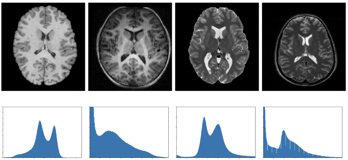 A Lifelong Learning Approach to Brain MR Segmentation Across Scanners and Protocols